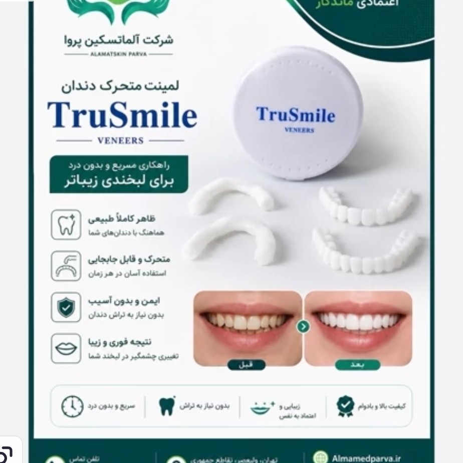 لمینت متحرک دندان ترواسمایل عمده 15 عددی