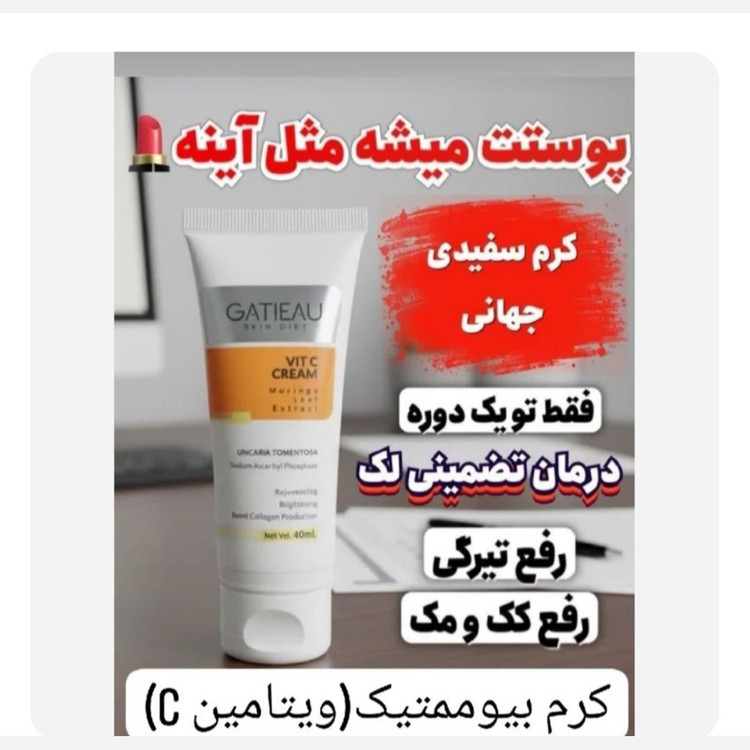 کرم ضدلک به شدت قوی بیوممتیک اصل اصل .
