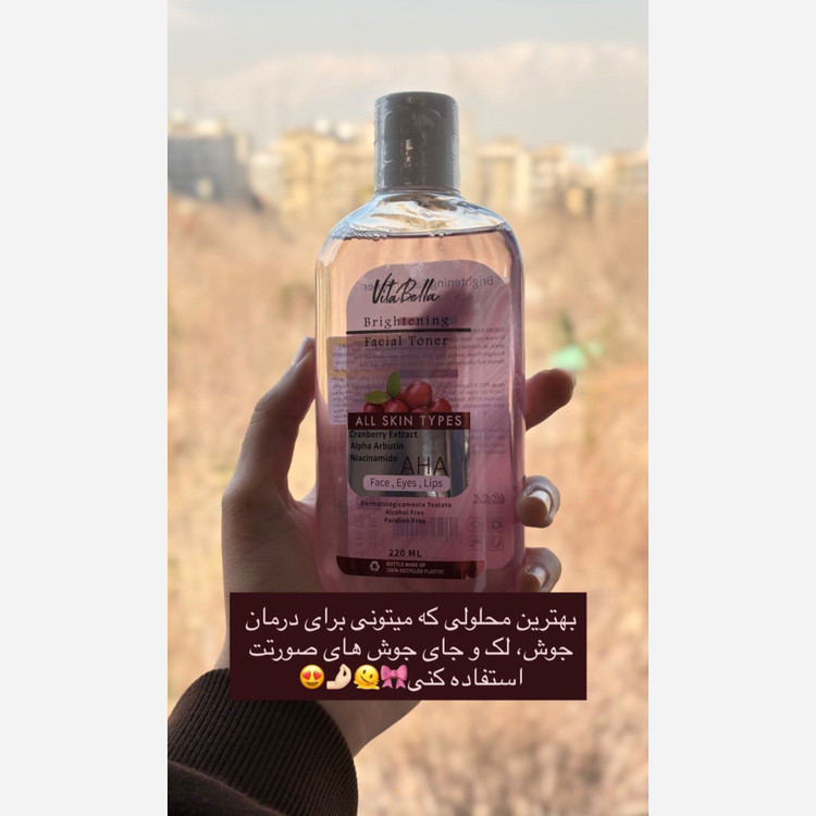 تونر تخصصی ضدلک و ضدمنافذ ویتابلا اصل